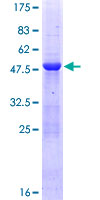 MED20 Protein - 12.5% SDS-PAGE of human TRFP stained with Coomassie Blue
