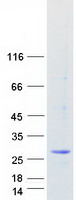 MED20 Protein - Purified recombinant protein MED20 was analyzed by SDS-PAGE gel and Coomassie Blue Staining