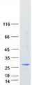 MED20 Protein - Purified recombinant protein MED20 was analyzed by SDS-PAGE gel and Coomassie Blue Staining