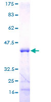 MED21 Protein - 12.5% SDS-PAGE of human SURB7 stained with Coomassie Blue