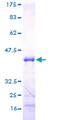 MED21 Protein - 12.5% SDS-PAGE of human SURB7 stained with Coomassie Blue