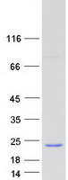 MED21 Protein - Purified recombinant protein MED21 was analyzed by SDS-PAGE gel and Coomassie Blue Staining