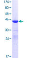 MED22 Protein - 12.5% SDS-PAGE of human MED22 stained with Coomassie Blue