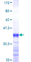 MED23 / SUR2 Protein - 12.5% SDS-PAGE Stained with Coomassie Blue.