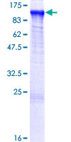 MED24 / TRAP100 Protein - 12.5% SDS-PAGE of human MED24 stained with Coomassie Blue