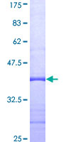 MED24 / TRAP100 Protein - 12.5% SDS-PAGE Stained with Coomassie Blue.