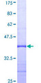 MED24 / TRAP100 Protein - 12.5% SDS-PAGE Stained with Coomassie Blue.