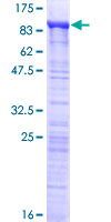 MED26 / CRSP7 Protein - 12.5% SDS-PAGE of human MED26 stained with Coomassie Blue
