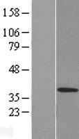 MED27 / CRSP8 Protein - Western validation with an anti-DDK antibody * L: Control HEK293 lysate R: Over-expression lysate