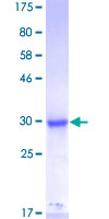 MED27 / CRSP8 Protein - 12.5% SDS-PAGE of human CRSP8 stained with Coomassie Blue