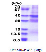 MED27 / CRSP8 Protein