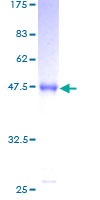 MED30 Protein - 12.5% SDS-PAGE of human THRAP6 stained with Coomassie Blue