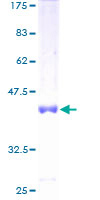 MED31 Protein - 12.5% SDS-PAGE of human MED31 stained with Coomassie Blue