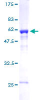 MED4 Protein - 12.5% SDS-PAGE of human MED4 stained with Coomassie Blue