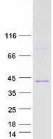 MED4 Protein - Purified recombinant protein MED4 was analyzed by SDS-PAGE gel and Coomassie Blue Staining