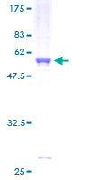 MED6 Protein - 12.5% SDS-PAGE of human MED6 stained with Coomassie Blue