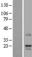 MED8 Protein - Western validation with an anti-DDK antibody * L: Control HEK293 lysate R: Over-expression lysate