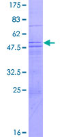 MED8 Protein - 12.5% SDS-PAGE of human MED8 stained with Coomassie Blue