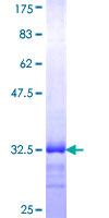 MED8 Protein - 12.5% SDS-PAGE Stained with Coomassie Blue