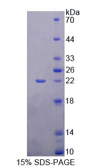 MEF2A / MEF2 Protein - Recombinant Myocyte Specific Enhancer Factor 2A By SDS-PAGE