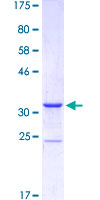 MEF2B Protein - 12.5% SDS-PAGE Stained with Coomassie Blue.