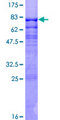 MEF2C Protein - 12.5% SDS-PAGE of human MEF2C stained with Coomassie Blue