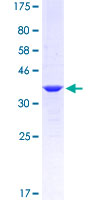 MEF2D Protein - 12.5% SDS-PAGE Stained with Coomassie Blue.