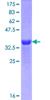 MEIS1 Protein - 12.5% SDS-PAGE Stained with Coomassie Blue.