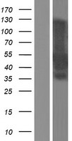MEIS2 Protein - Western validation with an anti-DDK antibody * L: Control HEK293 lysate R: Over-expression lysate