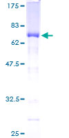 MEIS2 Protein - 12.5% SDS-PAGE of human MEIS2 stained with Coomassie Blue