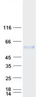 MEIS2 Protein - Purified recombinant protein MEIS2 was analyzed by SDS-PAGE gel and Coomassie Blue Staining