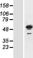 MEIS3 Protein - Western validation with an anti-DDK antibody * L: Control HEK293 lysate R: Over-expression lysate