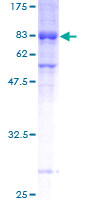 MEIS3 Protein - 12.5% SDS-PAGE of human MEIS3 stained with Coomassie Blue