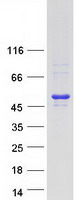 MEIS3 Protein - Purified recombinant protein MEIS3 was analyzed by SDS-PAGE gel and Coomassie Blue Staining