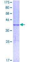 MELK Protein - 12.5% SDS-PAGE Stained with Coomassie Blue.