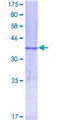 MELK Protein - 12.5% SDS-PAGE Stained with Coomassie Blue.