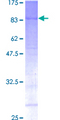 MEN1 / Menin Protein - 12.5% SDS-PAGE of human MEN1 stained with Coomassie Blue