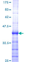 MEN1 / Menin Protein - 12.5% SDS-PAGE Stained with Coomassie Blue.