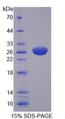 MEN1 / Menin Protein - Recombinant Multiple Endocrine Neoplasia I By SDS-PAGE