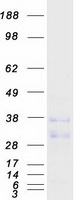 MENT / C1orf56 Protein - Purified recombinant protein C1orf56 was analyzed by SDS-PAGE gel and Coomassie Blue Staining