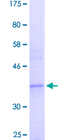 MEOX1 Protein - 12.5% SDS-PAGE Stained with Coomassie Blue.