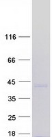 MEOX1 Protein - Purified recombinant protein MEOX1 was analyzed by SDS-PAGE gel and Coomassie Blue Staining