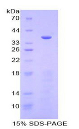 MEP1A / Meprin Alpha Protein - Recombinant Meprin A Alpha By SDS-PAGE