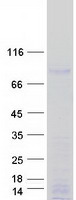 MEPCE Protein - Purified recombinant protein MEPCE was analyzed by SDS-PAGE gel and Coomassie Blue Staining