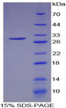 MEPE Protein - Recombinant Matrix Extracellular Phosphoglycoprotein By SDS-PAGE