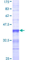 MER / MERTK Protein - 12.5% SDS-PAGE Stained with Coomassie Blue.