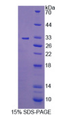 MER / MERTK Protein - Recombinant C-Mer Proto Oncogene Tyrosine Kinase By SDS-PAGE