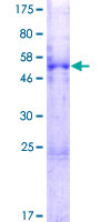 MESDC2 / MESD Protein - 12.5% SDS-PAGE of human MESDC2 stained with Coomassie Blue