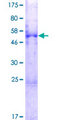 MESDC2 / MESD Protein - 12.5% SDS-PAGE of human MESDC2 stained with Coomassie Blue