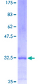 MESP1 Protein - 12.5% SDS-PAGE Stained with Coomassie Blue.